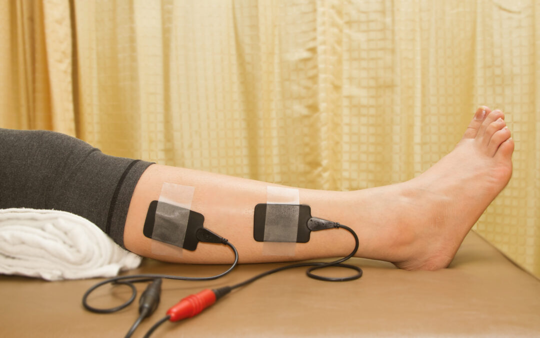 Electrical Stimulation and Post-Stroke Recovery