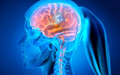 BDNF And Stroke Recovery