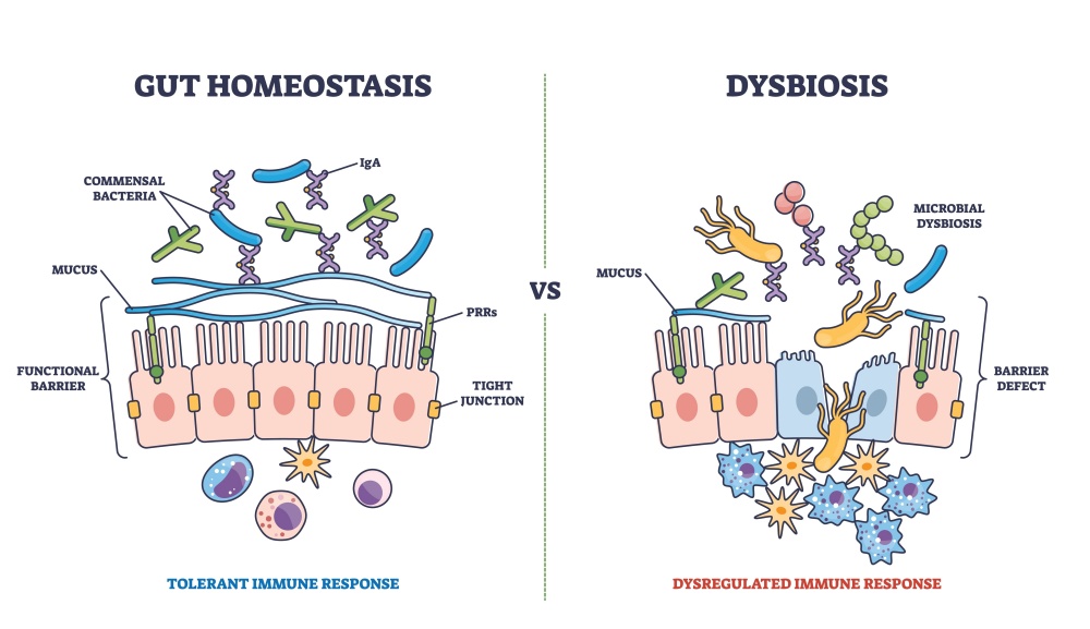vector image of healthy gut next to intestine with dysbiosis