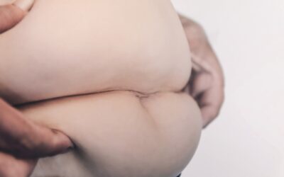 Pelvic Organ Prolapse: What You Need To Know